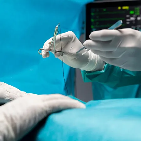 Chirurgie gynécologique