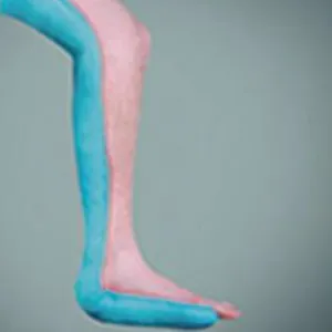 Fixation des pieds